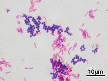 thick cell walls, appear purple after Gram staining procedure, and are easily killed with penicillin GRAM NEGATIVE: organisms with thin, lipid filled cell walls, appear pink after Gram