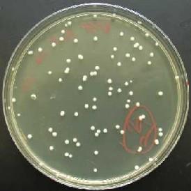 2:5 Growth and Preparation of a Pure Culture PURE CULTURE: culture containing only one species of microorganism MEDIUM: nutrient substance used to grow microorganisms COLONY: visible