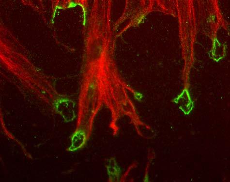 Here a red fluorescent dye, which sticks to fibres in the cytoplasm, shows