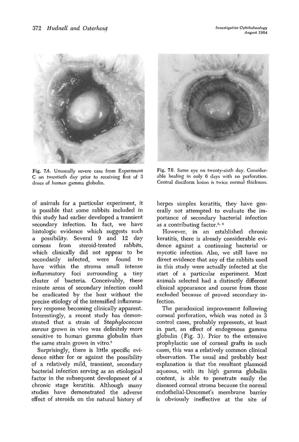 sligalioe Ophthalmology August 96 7 Hudnell and Osterhout Fig. 7A. Unusually severe case from Experiment C on twentieth day prior to receiving first of doses of human gamma globulin. Fig. IB.