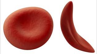 3. Hemoglobin is the protein in red blood cells that allows these cells to carry oxygen.