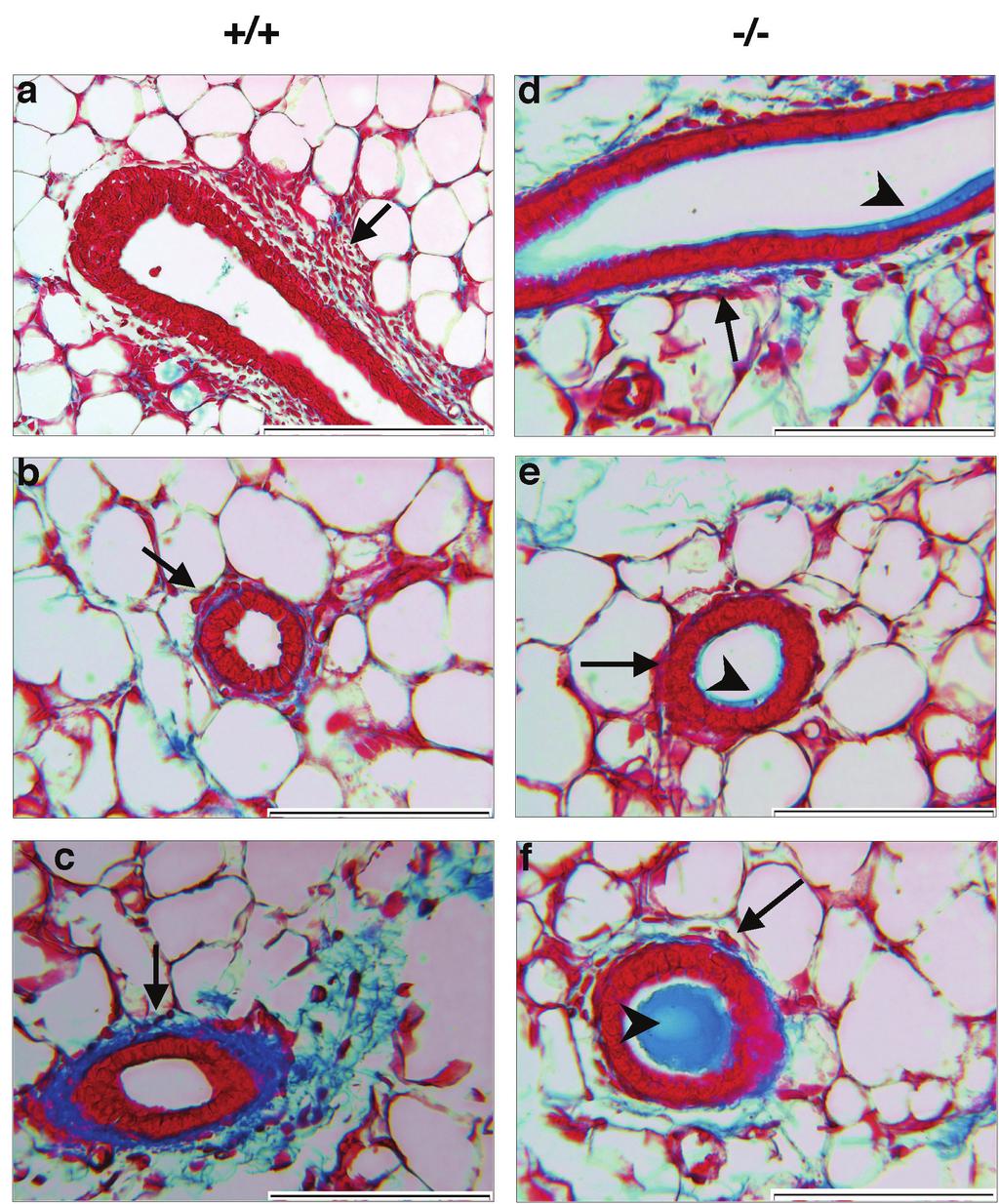 Supplementary Figure 6. The mir-212/132-/- mammary gland has structural defects in the periductal stroma.