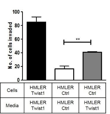 Lanes: (1) GFP + HMLER-Ctrl cells, (2) trfp + HMLER-Snail1 cells, (3, 4) GFP + HMLER-Ctrl cells from (3) 1:1 and (4) 10:1