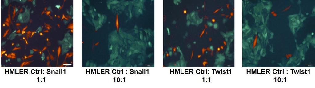 co-culture with HMLER-Twist1 cells.