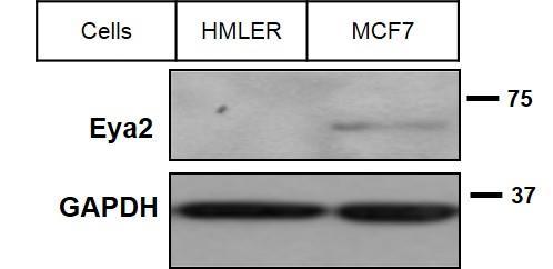 (g) Western blot analyses of whole cell lysates from HMLER and MCF7