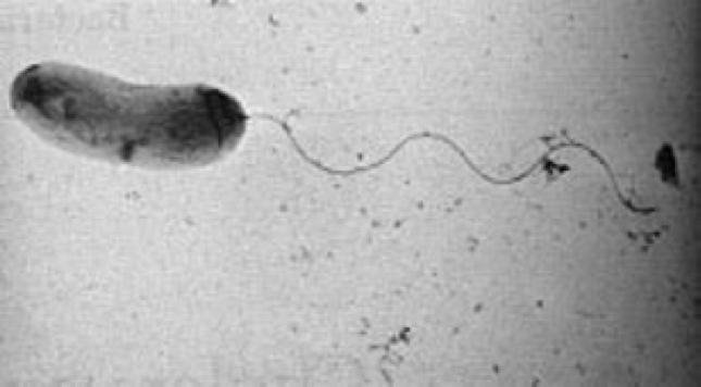 Intestinal wall Vibrio in the gut Pathogenesis due to excretion of cholera enterotoxin Uses flagellum