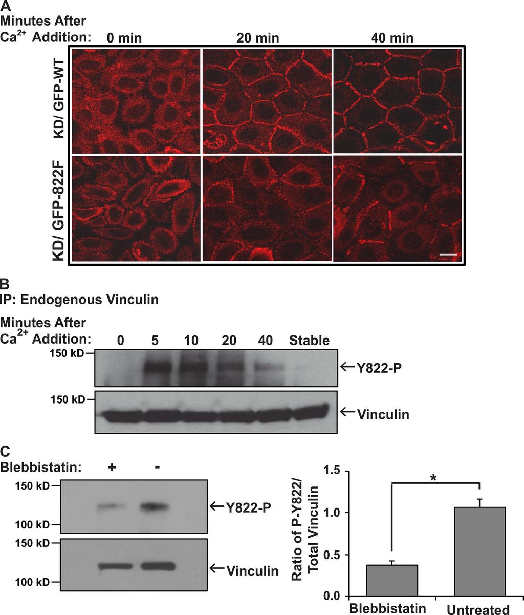 Figure S2. Examination of vinculin phosphorylation in response to cadherin engagement and in response to application of force on E-cadherin.