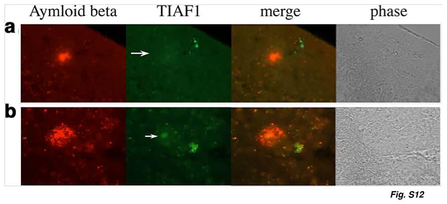 Figure S12. TIAF1 debris in large size Aβ plaques in the hippocampus of APP/PS1 transgenic mice.
