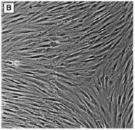 stromal cells Multipotent marrow stromal