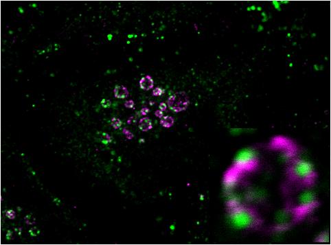The boxed regions indicate the Rab5(Q79L)-induced enlarged endosomes and are magnified in the