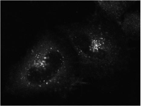 Cells were imaged by confocal microscopy.