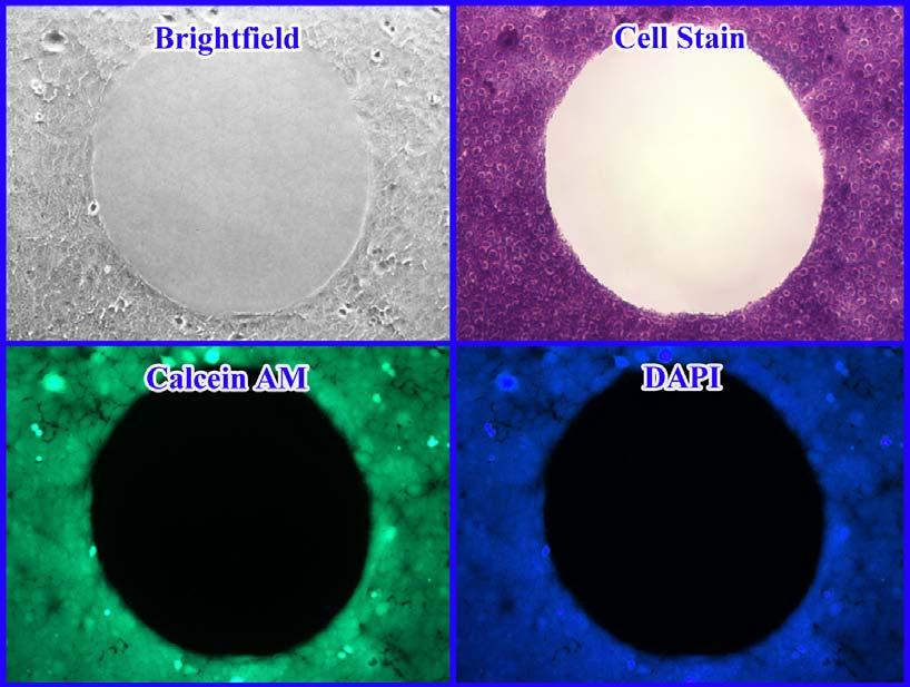 Example of Results The following figures demonstrate typical results with the Radius 24-well Cell Migration Assay Kit. One should use the data below for reference only.
