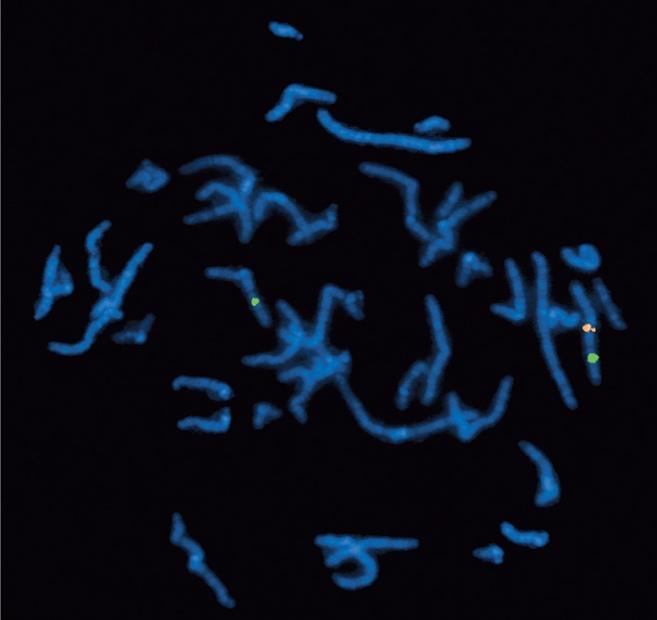 telomere, microdeletion specific,