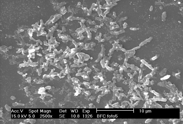 Microbial Fuel Cells: Carbohydrates