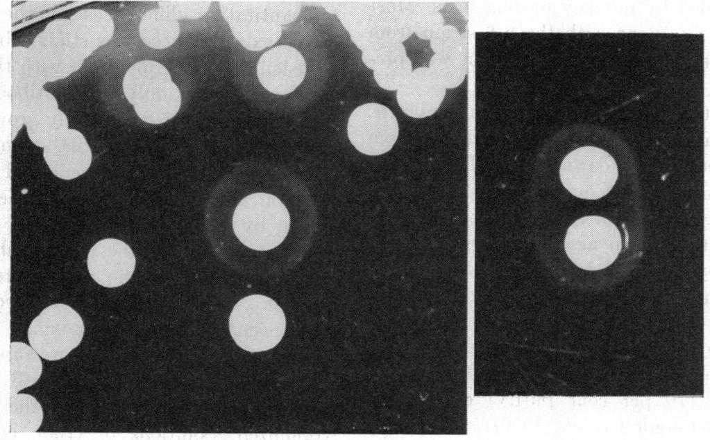 (Thorne and Belton, 1957; Strange and Thorne, 1958). Plain amigen agar was poured into petri plates, 12 ml/9 cm diameter plates.