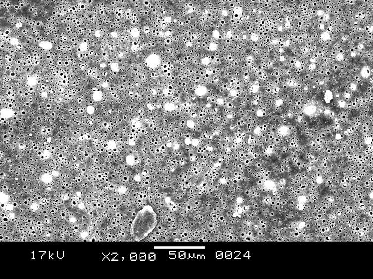 cucumulative % amount permeate from 3.7994 cm2 patch Figure 4: SEM of patch without the drug Ondansetron. ISSN: 2320-1215 Figure 5: SEM of drug loaded patch showing uniform dispersion of Ondansetron.