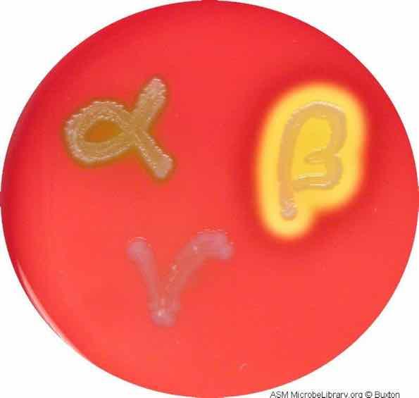 Bacterial Culture: type of hemolysis Observed on blood agar plate.