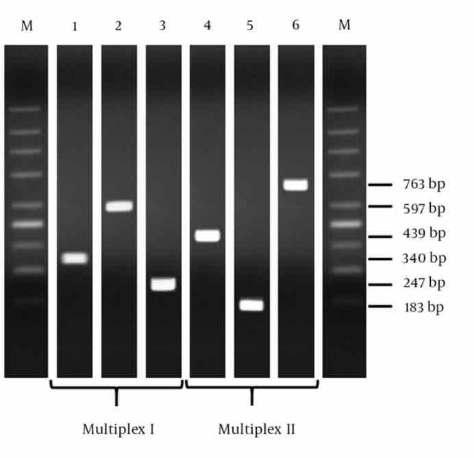 Carbapenem Resistance Genes Detection lane 1, control bla KPC gene; lane 2, control bla OXA- 48 gene; lane 3, control bla VIM gene; lane 4,