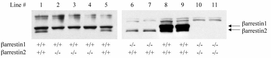 Fig. 1. Analysis of -arrestin expression in MEF cell lines. Whole cell lysates were prepared from 11 MEF cell lines and resolved (50 70 g of protein per lane) by SDS PAGE.