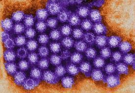 (low acid juices) Viruses Norovirus, Hepatitis A