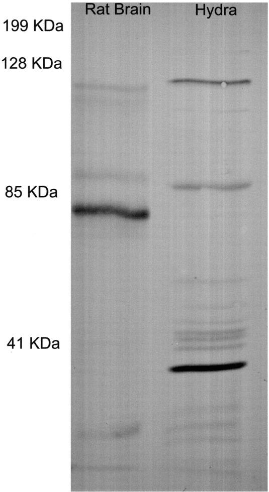 Western Blot 5. Blot proteins onto nylon membrane Developed Blot P 6. Visualize proteins using labeled antibodies 7.