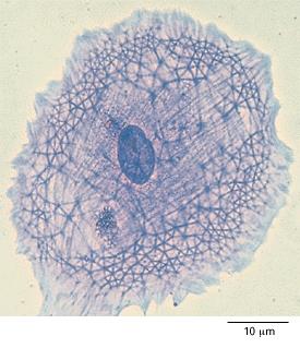 Example of Protein Stain Coomassie blue Figure 16-1 from Molecular Biology of the Cell The cytoskeleton. A cell in culture has been fixed and stained with Coomassie blue, a general stain for proteins.