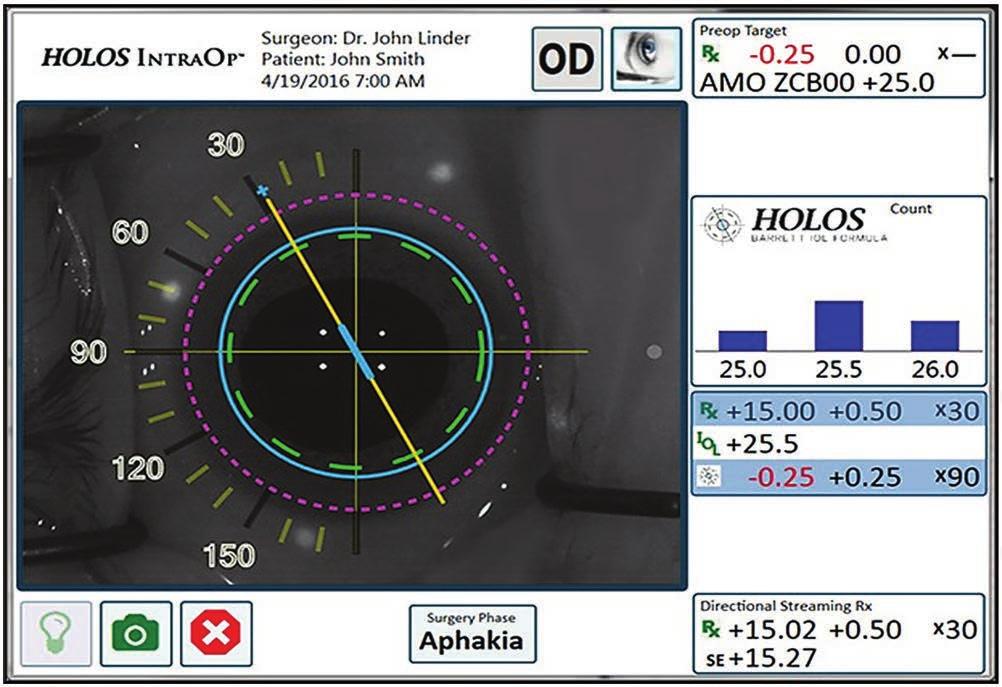 The HOLOS IntraOp system screen displays qualitative and quantitative data in real time.