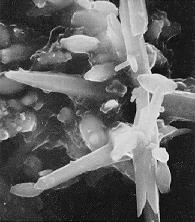 Calcium phosphate, magnesium silicate crystals