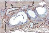 vascularized tissue is seen in the macroporous structure of the scaffold.