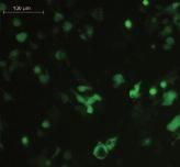 Cell culture treated microplates PDL Collagen type I Brightfield GFP Figure 4: GFP