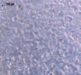 Cell culture treated microplates PDL Before transfection A 1day after transfection