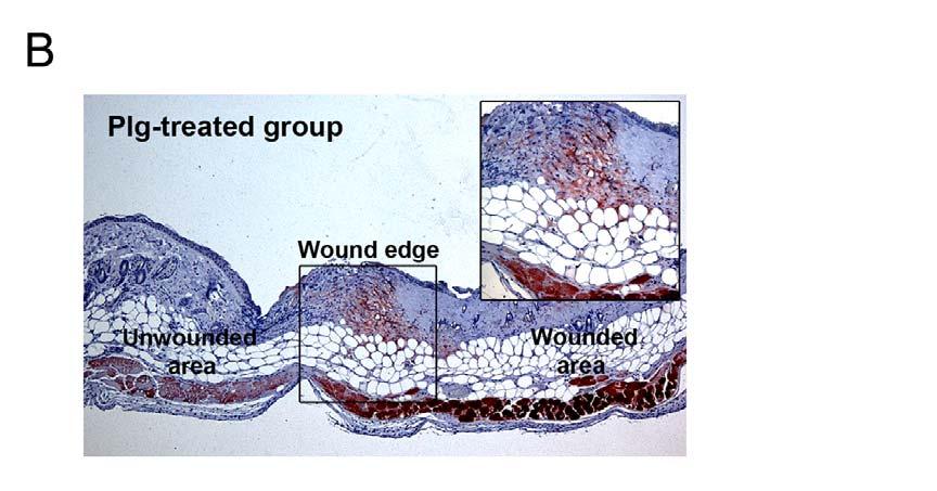 Figure S2. Immunohistochemical staining of human plg in wounds from plg-treated and untreated control mice Skin samples were collected 24 hours after wounding and plg injection.