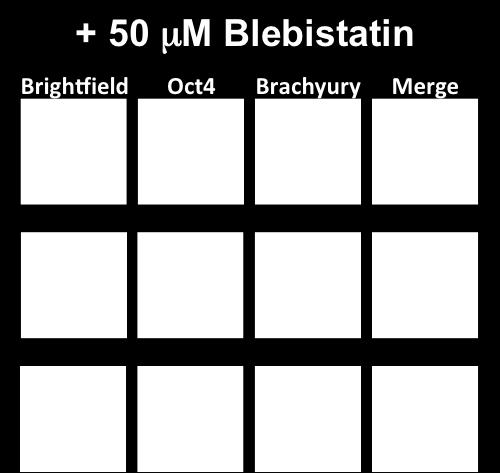 with 50 μm Blebistatin cultured under 3D soft fibrin LIF conditions for 5 days.