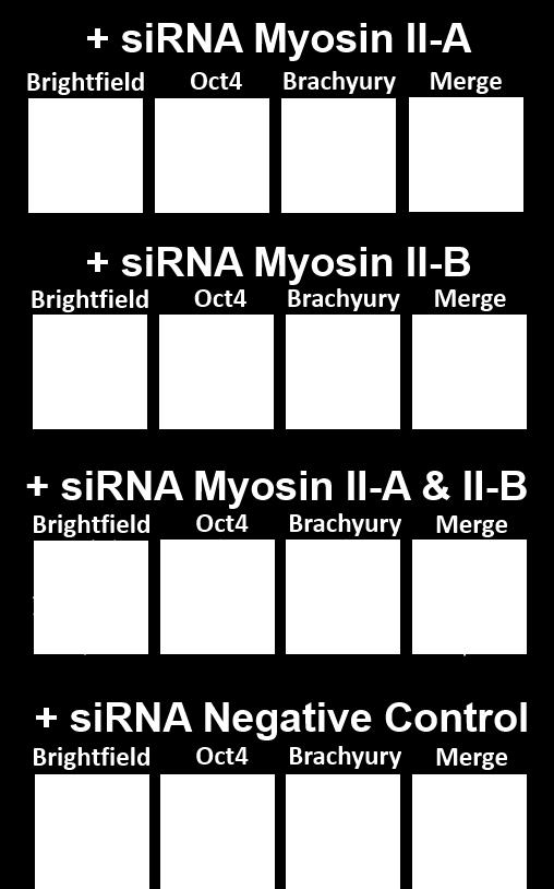 conditions for 5 days. No distinct organization of Brachyury-positive mesodermal cells was observed when Myosin II-A, Myosin II-B, and Myosin II-A & II-B were silenced.