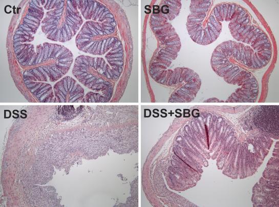 Proof of concept IBD SBG in the treatment of ulcerative colitis SBG protects against DSS-induced colitis, and has effect on epithelial proliferation and intestinal