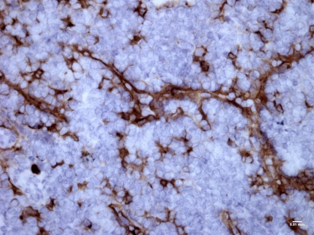 HM1047) Mannose receptor in mouse tonsil.