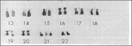 Chromosomes Chromosomes--Four Key Points 1. Number of chromosomes in each cell is important 2.