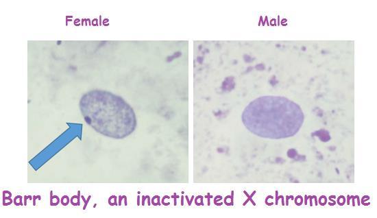 Gene expression is regulated in several ways: Gene expression C. X chromosome inactivation 1.