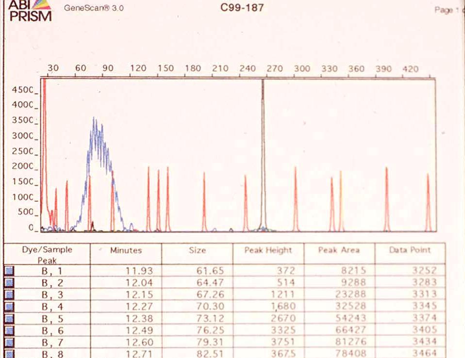 Capillary gel electrophoresis of PCR products