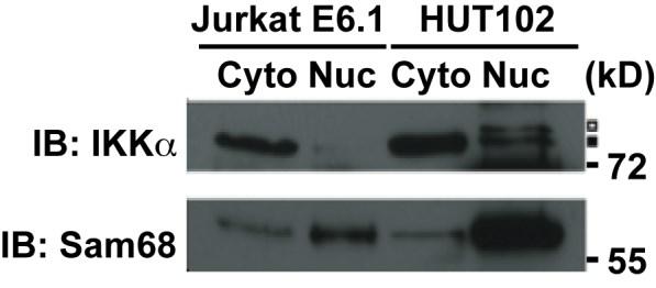 Supplementary Figure S11. Elevated nuclear IKKα in CD25 highly expressing HUT12 cells.