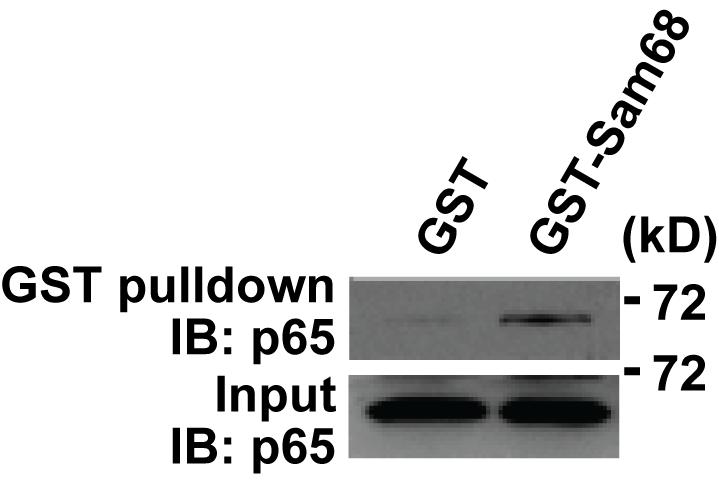 Supplementary Figure S1. The nuclear interaction of Sam68 and p65.