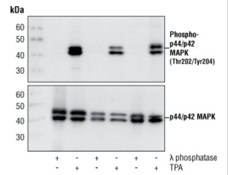 Ensure equal loading of a gel Blot with antibodies against the protein of interest is used as