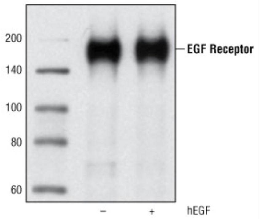 Western blot analysis of EGF