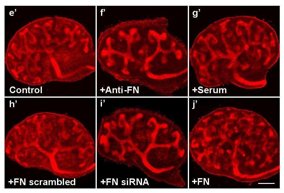 Inhibition of kidney branching morphogenesis by anti-fn antibody. E11.