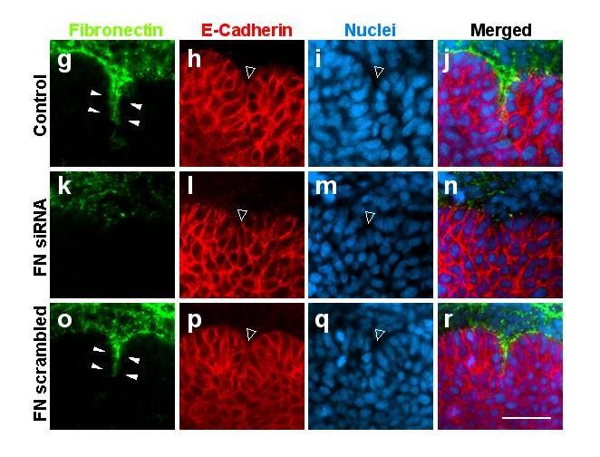 Silencing of FN protein expression in salivary epithelial tissue is shown by confocal immunofluorescence microscopy imaging of staining for FN (g, k, o), E- cadherin (h, l, p), or nuclei (i, m, q).
