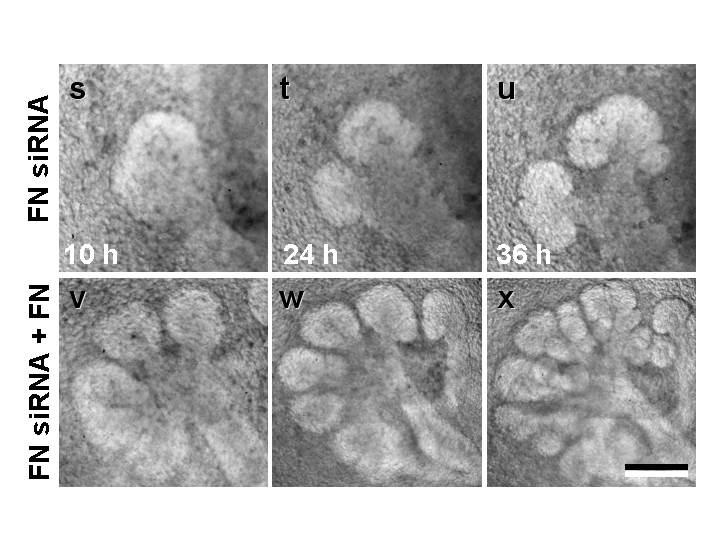 Exogenous fibronectin rescues sirna-suppressed glands.