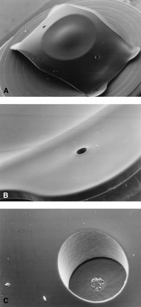 C, Claw ends show no sharp edges (original magnification, 175). Figure 4. SEM images of the Staar ICL posterior chamber one-piece plate-haptic phakic intraocular lens.