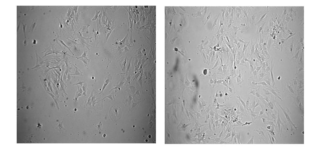result, the cells will peel off of the plastic which markedly reduces the ability to passage them. a. Warm Complete Growth Medium and Trypsin solution to 37 C by placing in 37 C H2O bath or in Tissue Culture Incubator b.