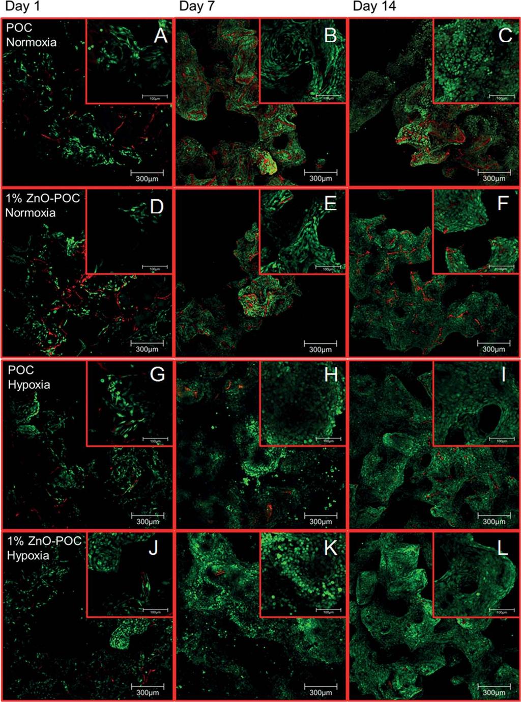 FIGURE 2. (A L) Live/dead assay of chondrocytes seeded on scaffold at day 1, 7, and 14 under normoxic and hypoxic conditions.