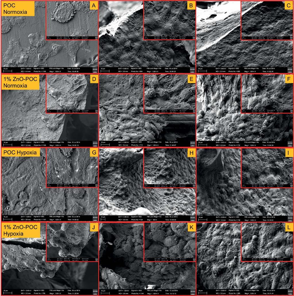 FIGURE 4. (A L) SEM images showing the morphologies of chondrocytes seeded on scaffold at day 1, 7, and 14 under normoxic and hypoxic conditions.